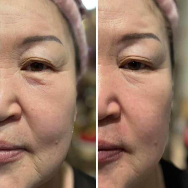 Выравнивающий пилинг для лица. Пилинг тса 20. Выравнивающий пилинг для лица. Выравнивающий пилинг для лица. Выравнивающий пилинг для лица.